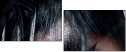 48588820