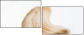 56309569