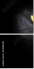 44285895
