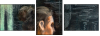 25060957