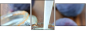 26311404