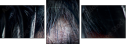 48588820