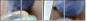 26311404