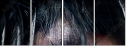 48588820