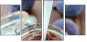 26311404